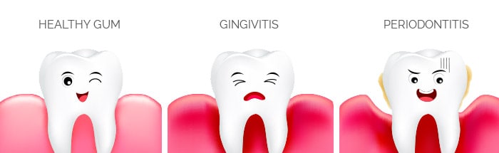 hornsby-gum-disease hornsby-gum-disease
